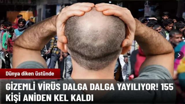 Hindistan'da ortaya çıkan yeni virüs nedeniyle 155 kişi aniden kel kaldı