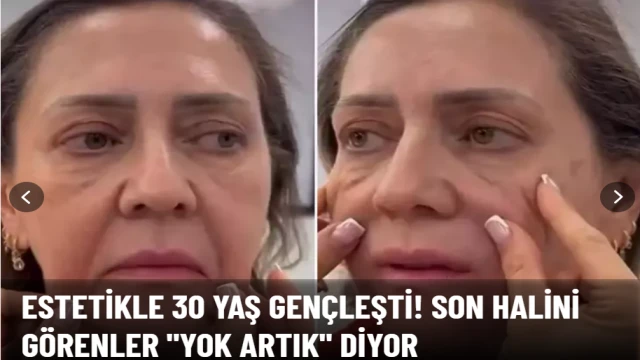 Son halini görenler "Yok artık" diyor