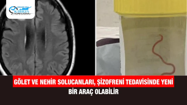 Gölet ve Nehir Solucanları, Şizofreni Tedavisinde Yeni Bir Araç Olabilir